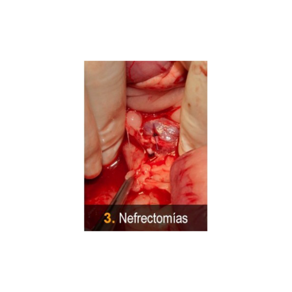 Vetpills “Técnicas quirúrgicas imprescindibles” -3 (nefrectomías)