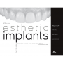 Esthetic Implants How to think about complex cases in anterior areas with a global approach to the patient smile