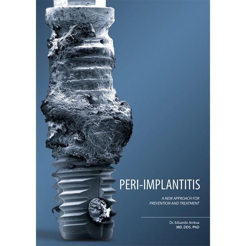Peri-Implantitis, A new approach for prevention and treatment