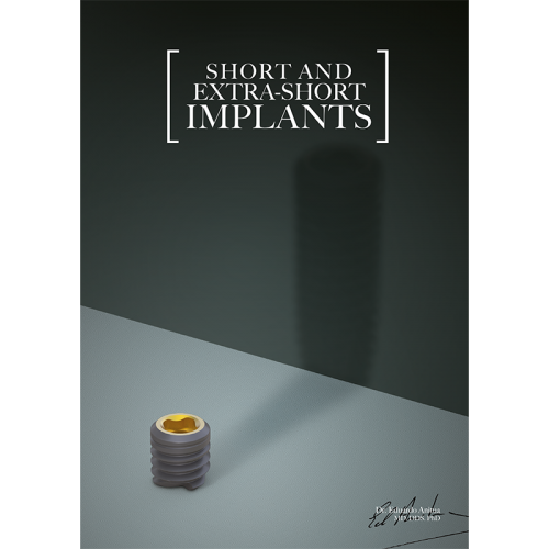 Short And Extra-Short Implants