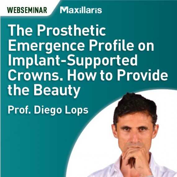 The prosthetic emergence profile on implant-supported crowns. How to provide the beauty