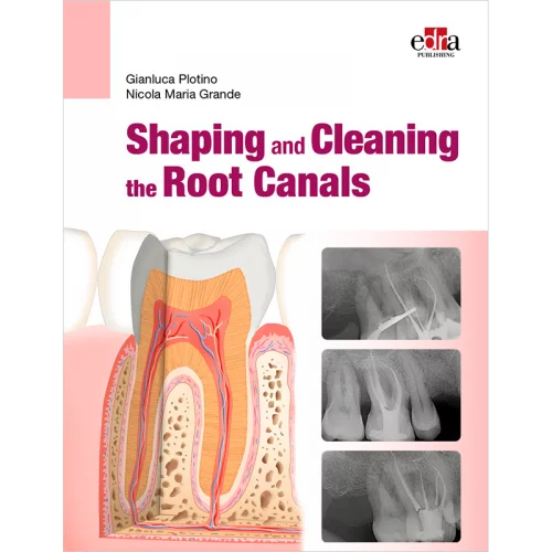 Shaping and Cleaning the Root Canals