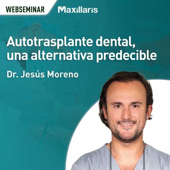 Autotrasplante dental, una alternativa predecible