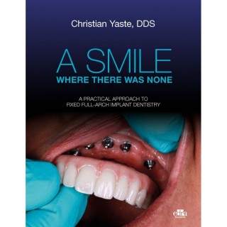 A SMILE WHERE THERE
WAS NONE. Christian Yaste
A PRACTICAL APPROACH TO FIXED FULL-ARCH
IMPLANT DENTISTRY
Christian Yaste, DDS