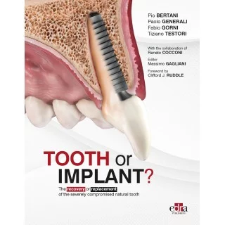 Portada del libro Tooth or Implant